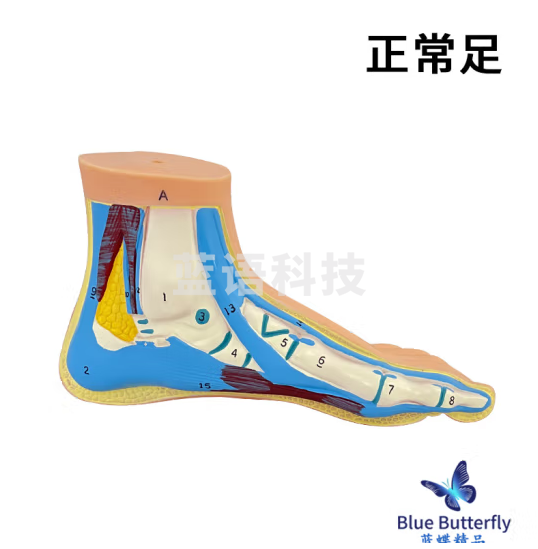蓝蝶 人体脚掌肌肉模型 平板足 正常足 足弓 扁平足 高弓足解剖模型 正常足-新款刻字