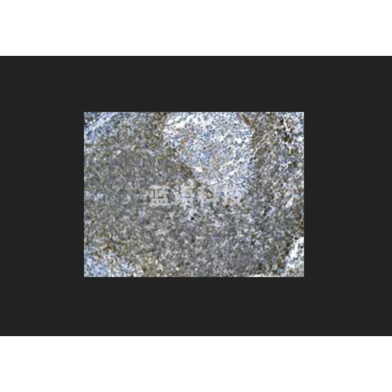 艾博抗 重组 Anti-TACI 抗体(abcam)