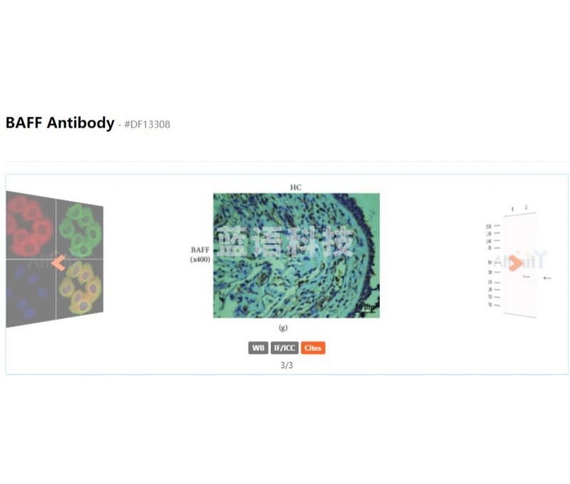 Affinity BAFF Antibody - #DF13308